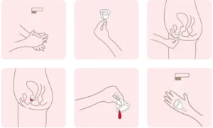 کاپ قاعدگی لیوا فارما